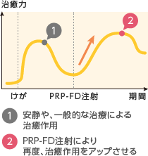 1. 安静や、一般的な治療による治癒作用 / 2. PRP-FD（PFC-FD）注射により再度、治癒作用をアップさせる